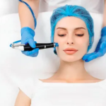 Is Hydrafacial a Safe and Consistent Solution for Ongoing Acne Care?