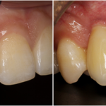 What Is Affordable Family Dentistry and Why It Matters