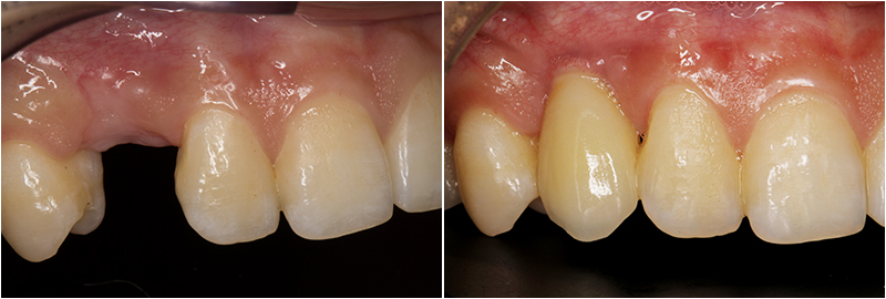 What Is Affordable Family Dentistry and Why It Matters