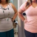 Body Lift in Dubai – Complete Guide to Body Contouring Surgery