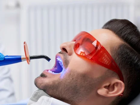 Top Reasons to Choose a Dental Clinic for Professional Teeth Whitening