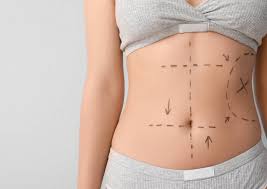 Tummy Tuck Cost: Factors That May Influence the Total Price