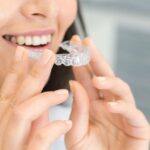 Want Straighter Teeth Without Metal Braces? Try Invisible Braces Treatment in Nashik