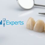 Zirconia Crown Price in Pakistan 2026: Complete Cost Guide & Ceramic Comparison