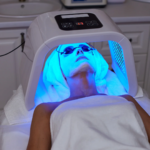 Why Finding the Best Acne Scarring Treatment in Houston Is Worth Every Penny