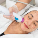 What to Expect During Thermage Skin Tightening in Dubai