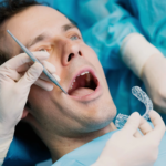 After Tooth Extraction: Common Side Effects and Warning Signs You Should Know