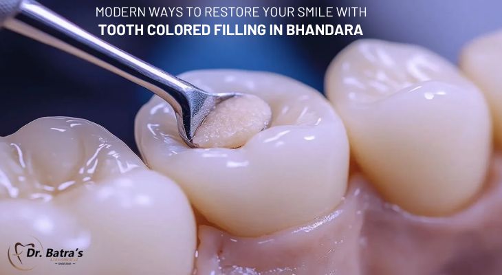 Modern Ways to Restore Your Smile with Tooth Colored Filling in Bhandara