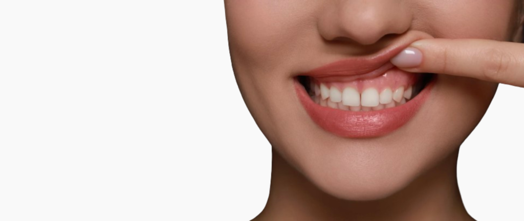 How Painless Gum Treatment in Surat Can Save Your Teeth Before It’s Too Late