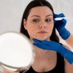 Polynucleotide Injections: Benefits, Risks, and What to Expect