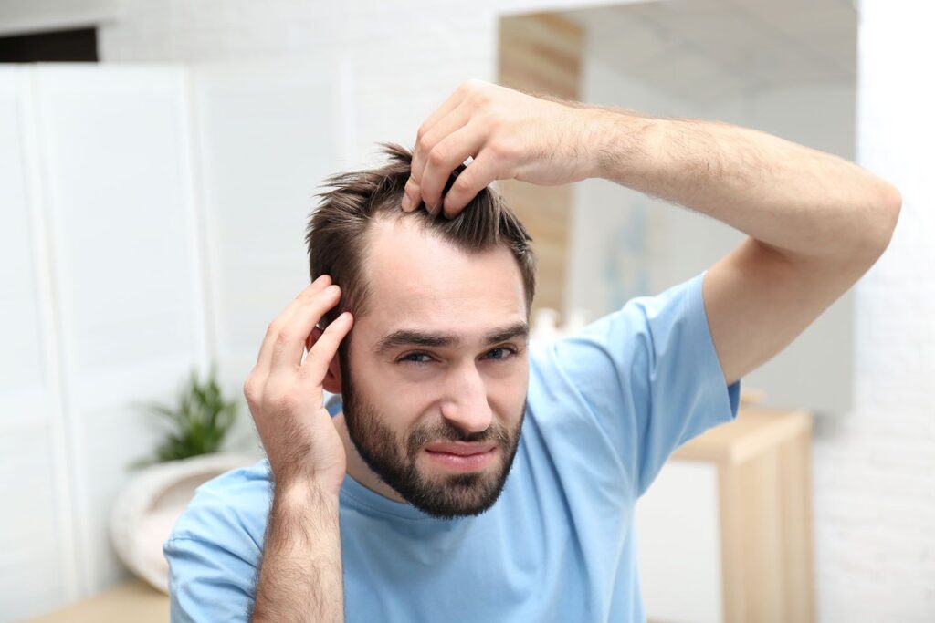 Scalp Micropigmentation for Women Breaking the Stigma