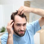 Scalp Micropigmentation for Women Breaking the Stigma