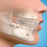 Oral and Maxillofacial Surgery Explained: When It’s Needed