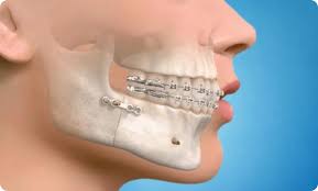 Oral and Maxillofacial Surgery Explained: When It’s Needed