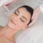 Pre-Treatment Tips Before Cold Peeling Session