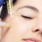Natural Alternatives to Mesotherapy: Do They Work?