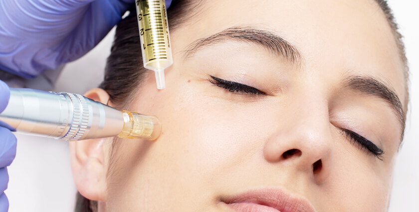 Natural Alternatives to Mesotherapy: Do They Work?
