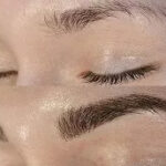 Best Eyebrow Hair Transplant in Dubai: Expert Tips for Natural Results