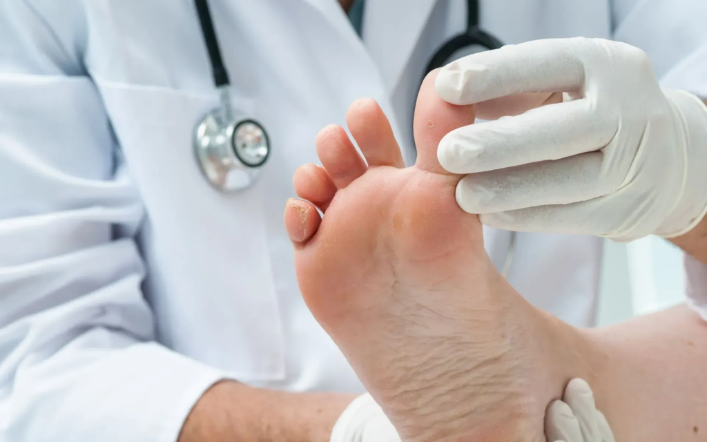 Step Into Relief: The Best Plantar Fasciitis Treatment You Need to Try Today v