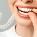 Smile Confidently with Invisible Braces