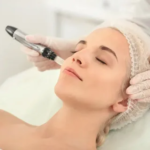 Microneedling Treatment vs Mesotherapy: Which One is Better?
