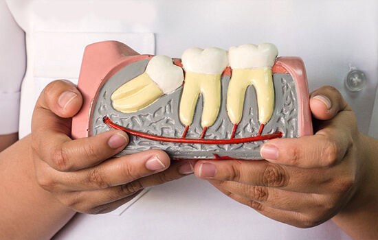 Wisdom Tooth Removal Treatment Cost and Recovery Timeline