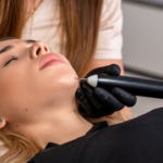 Mole Removal Cost in Bangalore: Is the Treatment Worth It?