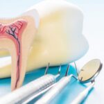 Painless Root Canal Treatment by Specialist in Sinhagad Road