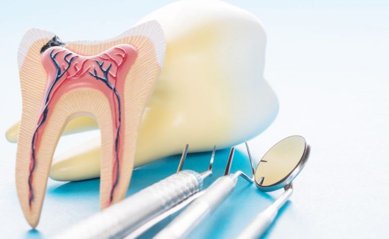 Painless Root Canal Treatment by Specialist in Sinhagad Road