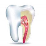 Trusted Root Canal Specialist in Solapur for Safe RCT Treatment