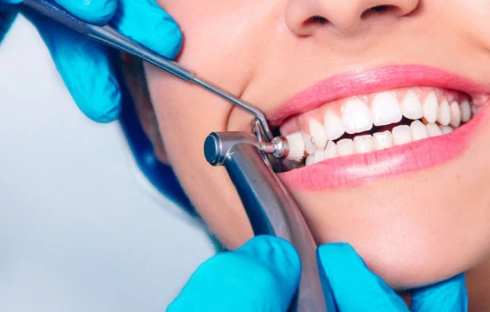 Top Signs You Need a Professional Teeth Cleaning
