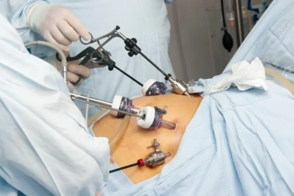 Myomectomy: Types, Benefits, Risks, Recovery, and How It Compares to Uterine Fibroid Embolization