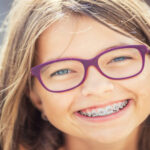 Dental Veneers – Concepts, Types, and Clinical Applications