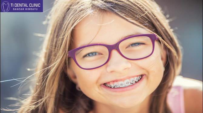 Dental Veneers – Concepts, Types, and Clinical Applications