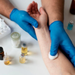 Homoeopathic Case Analysis Methods in Patients with Vitiligo