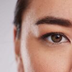 Upper Blepharoplasty Dubai Treatments for Eyelid Rejuvenation
