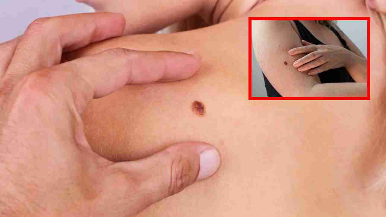 Symptoms Of Cancer : మీకు క్యాన్సర్ ఉంటే కనిపించే ముందస్తు సంకేతాలు !