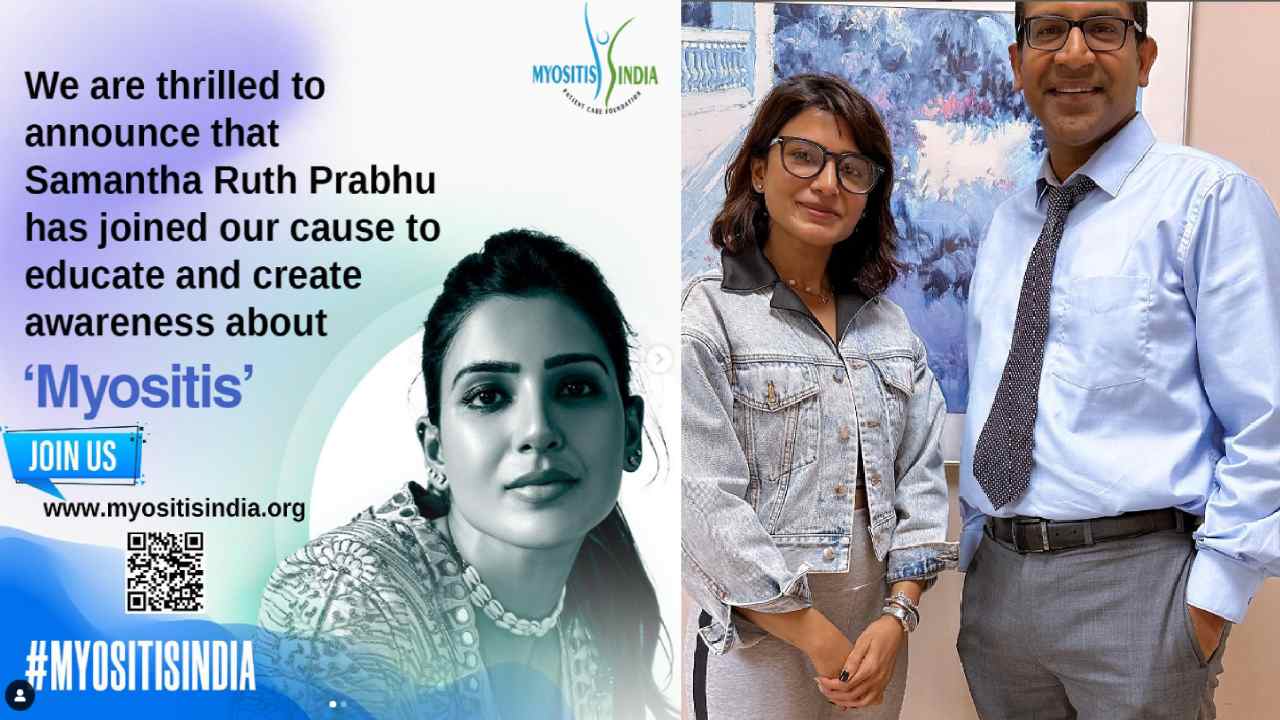 Samantha : మయోసైటిస్ బాధితులు కోసం రంగంలోకి దిగుతున్న సమంత..
