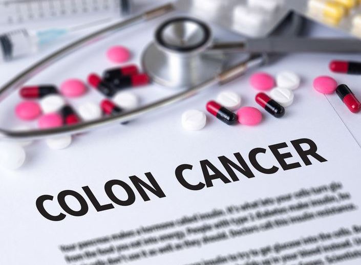 Colon cancer growth reduced by exercise: Study