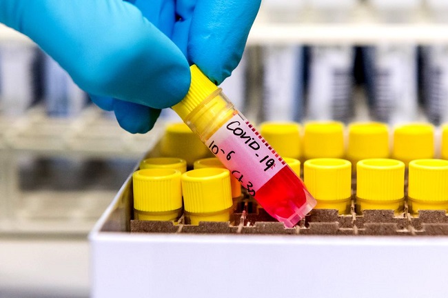 Coronavirus Treatment: Stimulating immune responses in early stages of COVID-19 may hold key to its effective treatment