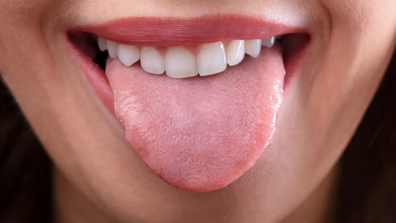 Health: These 5 signs on your tongue can make you sick