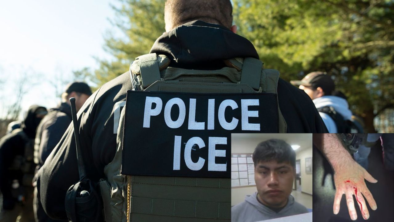 US immigrant bites ICE officer while resisting arrest in Louisiana; DHS releases injury photo