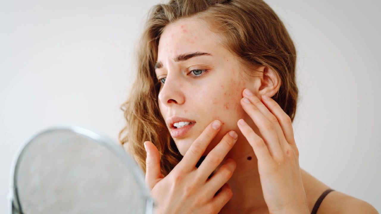 Wrinkles, Dark Spots, and Dryness: Signs pollution is damaging your skin more than you realise