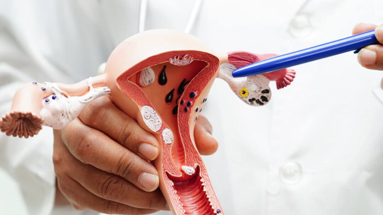 These 4 symptoms may signal Cervical cancer; Early testing can save lives