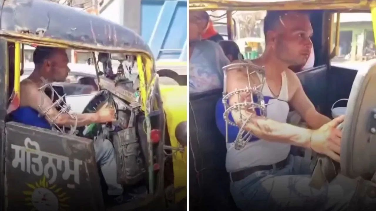 Man drives auto with fractured arm; Internet calls him real hero