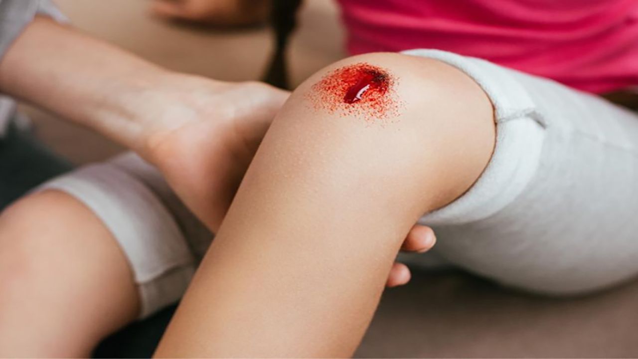 5 Things People With Haemophilia Should Avoid To Prevent Serious Complications