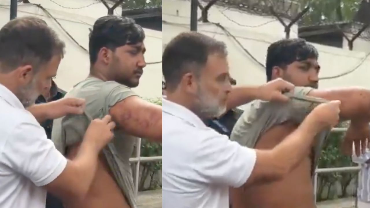 Rahul Gandhi Shows Student With Pellet Injury, Calls Dharmendra  Pradhan ‘Criminal Education Minister’ Amid NEET Protest