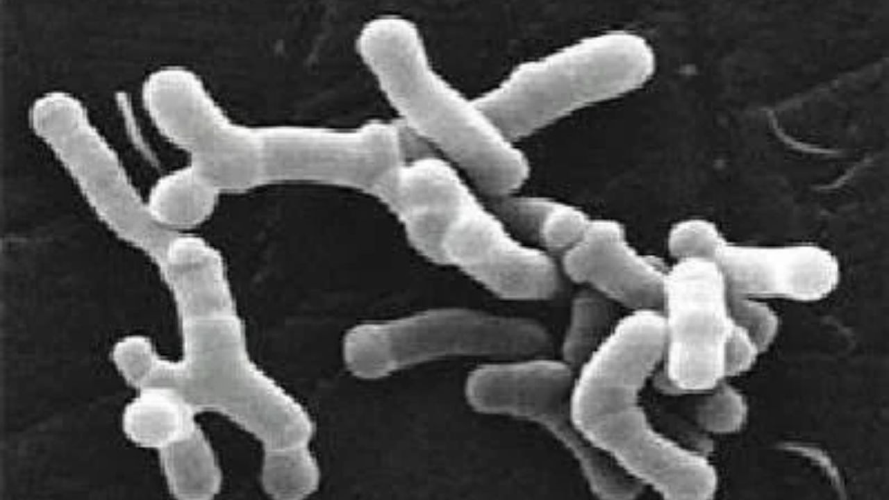 Pancreatic Cancer Breakthrough? Scientists Engineer Gut Bacteria to Attack Tumours