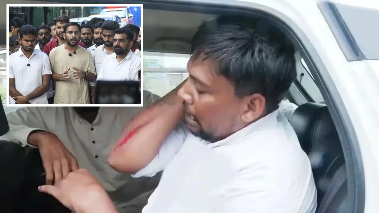 ‘We Were Hit With Sticks’: Injured CJP Member Alleges BJP-RSS Attack In Rajasthan, Shows Injuries
