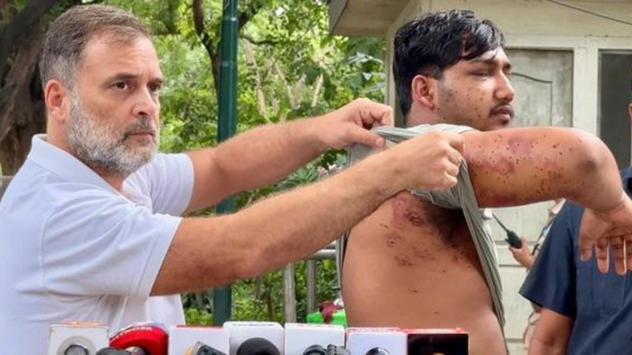 BJP Slams Rahul Gandhi’s Pellet Gun Protest, Calls It ‘Politics of Anarchy’ Amid FIR Demand Row
